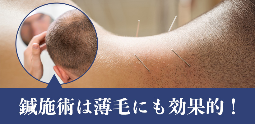 薄毛に鍼施術は効果がある？